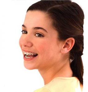 Adolescent patient wearing braces