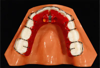 Occlusal appliance