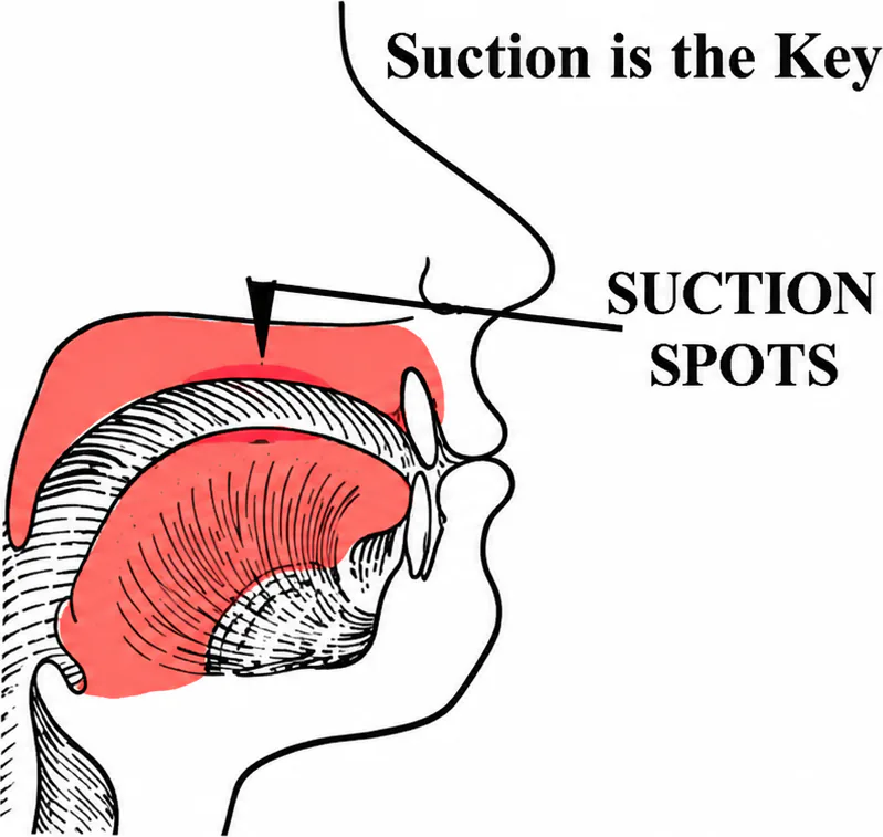 Diagram of the tongue suction spot on the palate